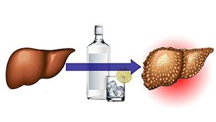 vplivi alkohola na jetra